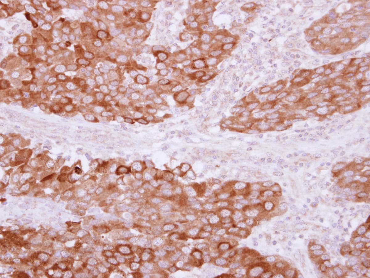 Polyclonal Rabbit anti-Human PITPNB Antibody (IHC, WB)