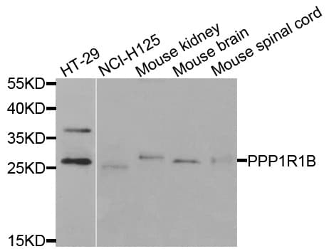 IHC-plus™ PPP1R1B / DARPP-32 Antibody
