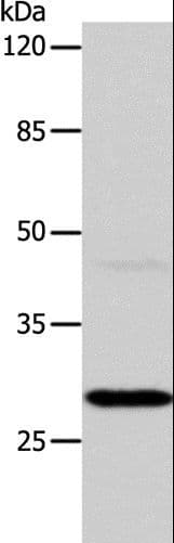 Polyclonal Rabbit anti-Human CA1 / Carbonic Anhydrase I Antibody (WB)