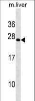 PRRX2 / PRX2 Antibody (aa223-250)