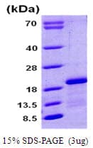 Human CPLX1 / Complexin 1 Protein (Recombinant His)