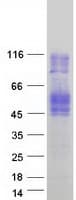 Human CD84 / SLAMF5 Protein (Recombinant Myc-DDK (Flag))