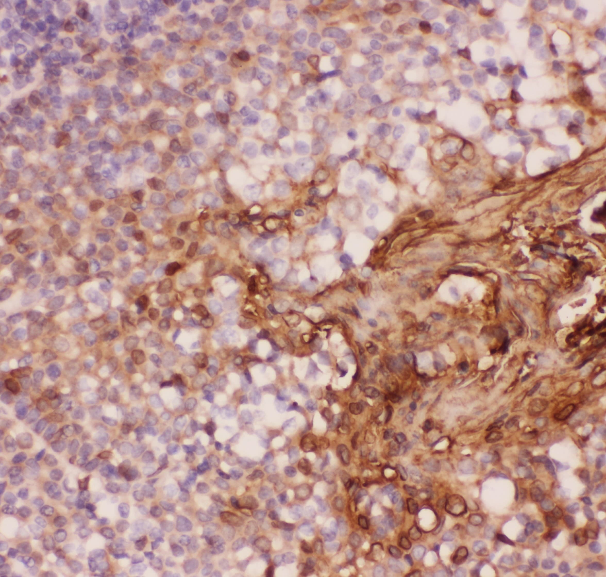 ANXA1 / Annexin A1 Antibody (aa2-346)