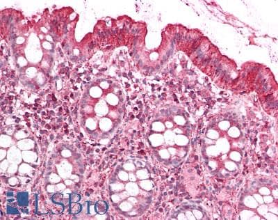 FXN / Frataxin Antibody (aa57-198)