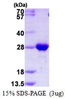 Human RAB2B Protein (Recombinant His)