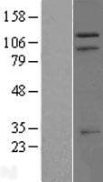 TRIM37 / TEF3 Protein (Over-Expression Lysate Myc-DDK (Flag))