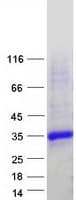 Human KCTD2 Protein (Recombinant Myc-DDK (Flag))
