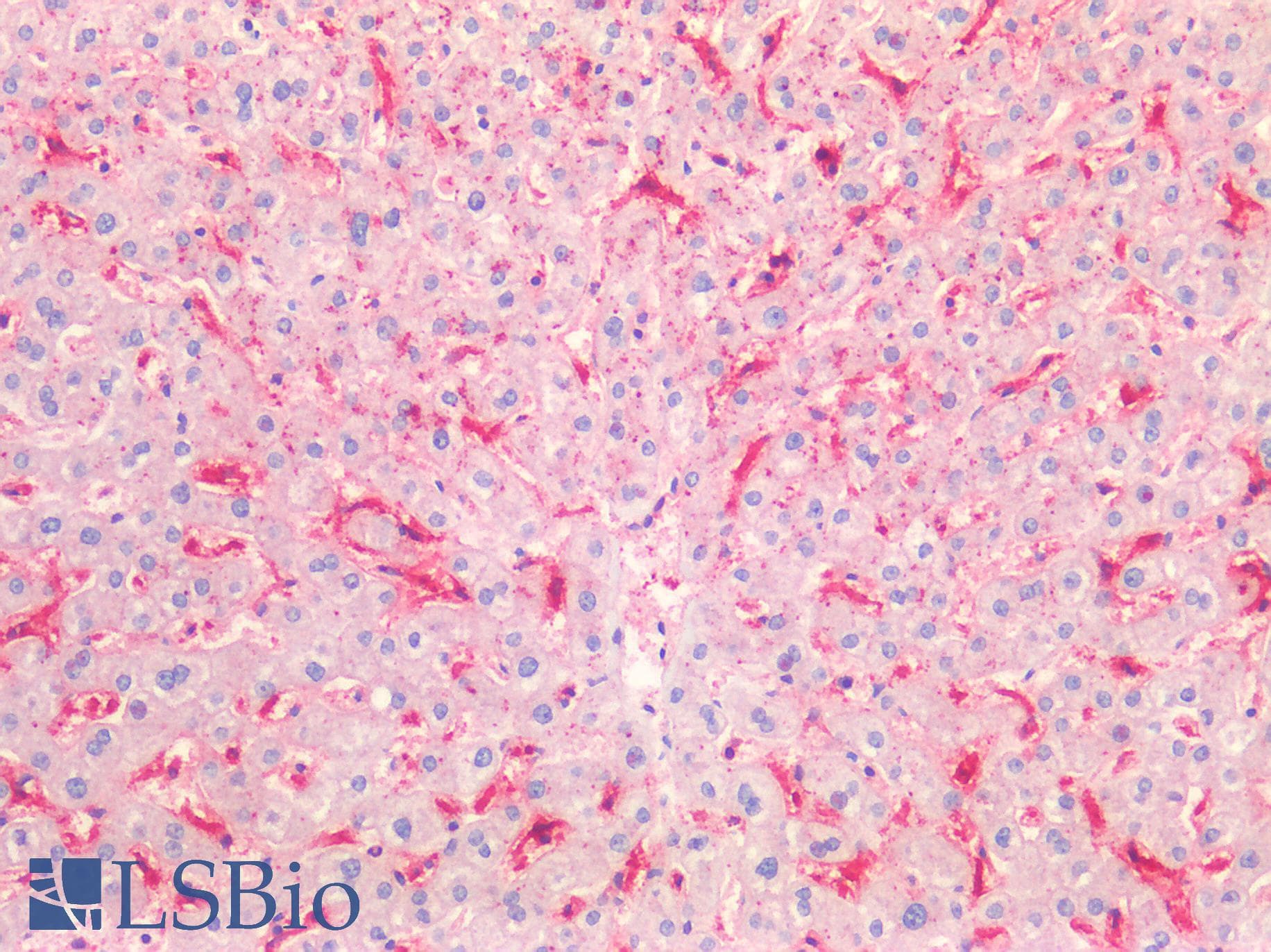 IHC-plus™ FCER1G Antibody