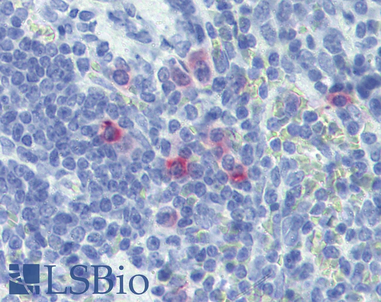 IHC-plus™ Monoclonal Mouse anti-Rat IL13 Antibody (clone 5J56, IHC)