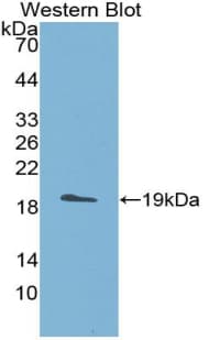 ADAMTS5 Antibody (aa485-622, APC)