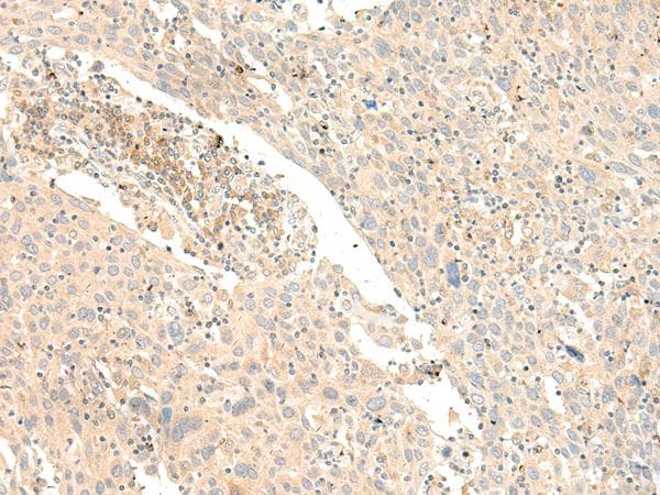 GLIS1 Antibody