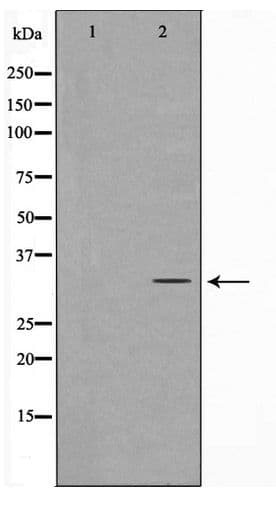 Polyclonal Rabbit anti-Human NEUROD1 Antibody (WB)