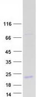 Human ORM2 / Orosomucoid 2 Protein (Recombinant Myc-DDK (Flag))