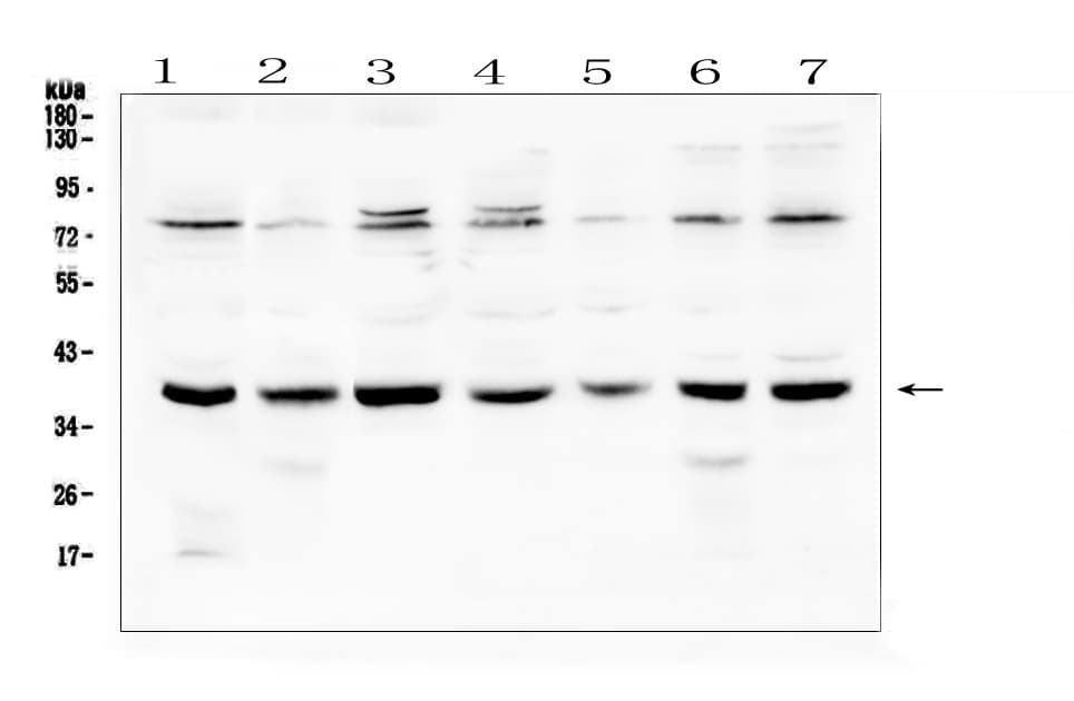 RAD51 / RECA Antibody