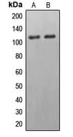 EPB41L2 Antibody (Internal)