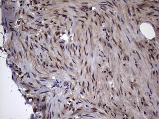 DOT1L / DOT1 Antibody (aa1-434, clone OTI1D8)
