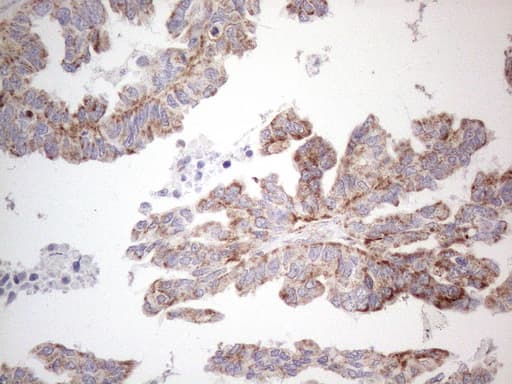 Monoclonal Mouse anti-Human BP1 / DLX4 Antibody (clone OTI8A1, IHC, WB)