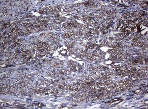 CTSL / Cathepsin L Antibody (clone OTI6B8)