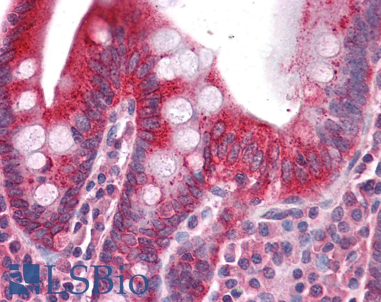 IHC-plus™ Polyclonal Rabbit anti-Human TNFRSF25 / DR3 Antibody (IHC, WB)
