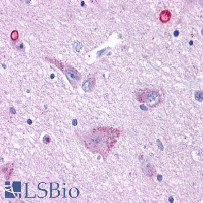 PathPlus™ GPR50 Antibody (Cytoplasmic Domain)