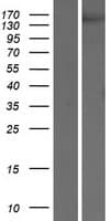 KDR / VEGFR2 / FLK1 Protein (Over-Expression Lysate Myc-DDK (Flag))