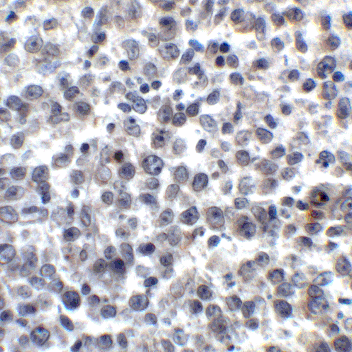 TNFSF14 / LIGHT Antibody (clone 7B9E12)