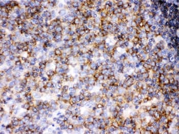 Polyclonal Rabbit anti-Human p56lck / LCK Antibody (IHC, WB)