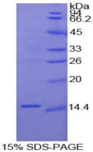 Human FN1 / Fibronectin Protein (Recombinant His)