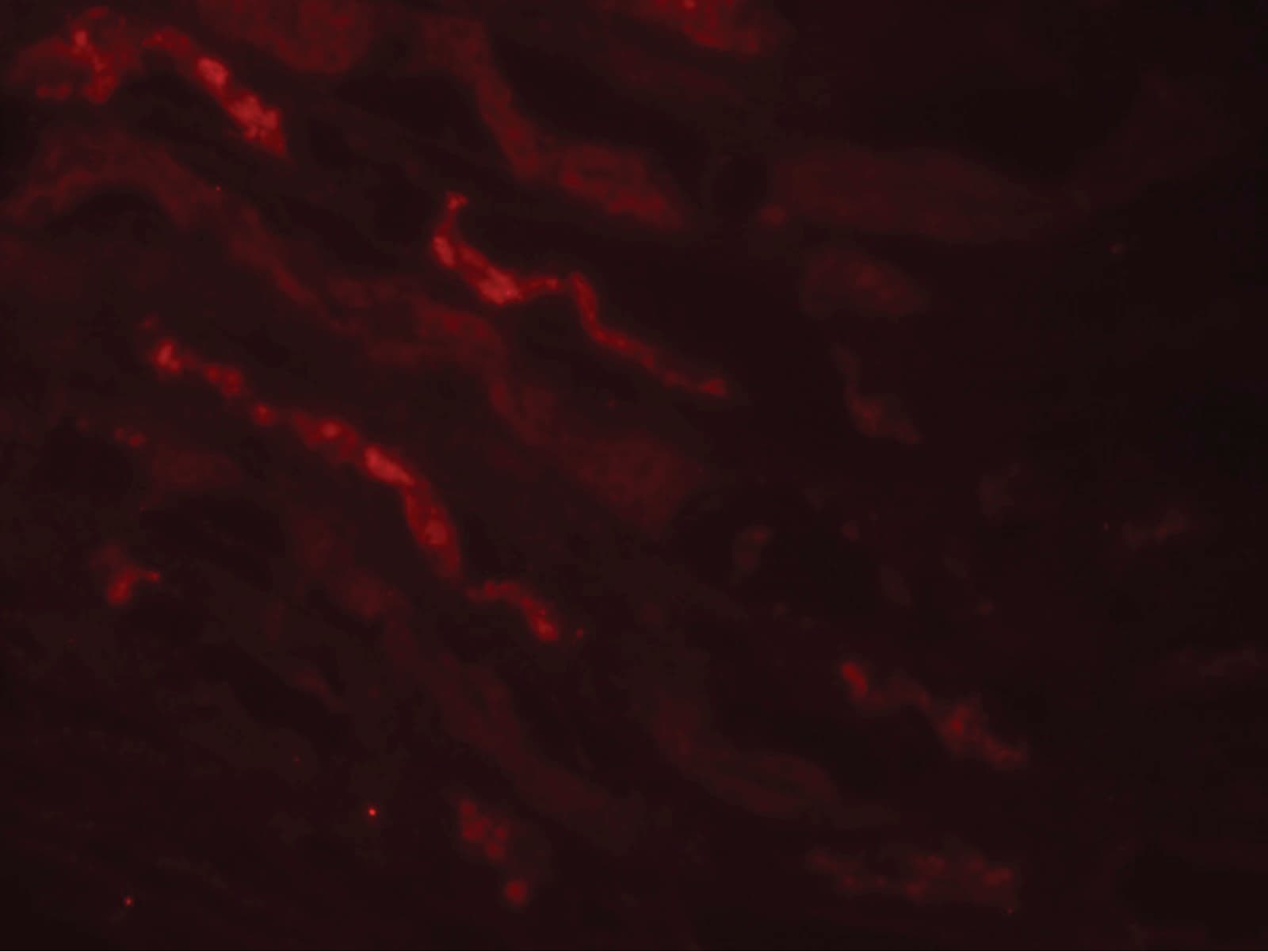 Polyclonal Rabbit anti-Human KLK4 / Kallikrein 4 Antibody (IHC, IF, WB)