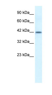 ESR2 / ER Beta Antibody (aa82-131)