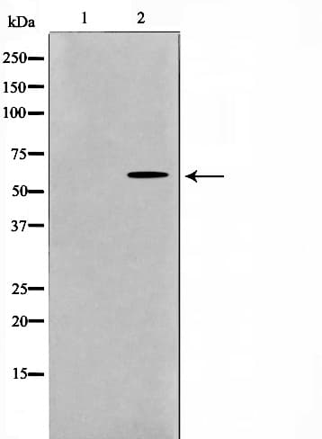 Polyclonal Rabbit anti-Human GK / Glycerol Kinase Antibody (IF, WB)