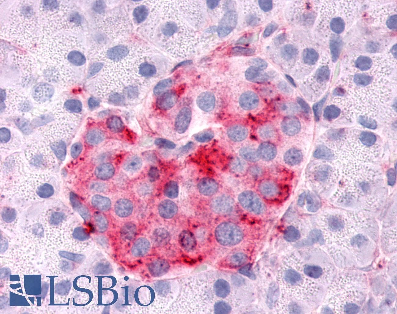 PathPlus™ SGK3 Antibody (N-Terminus)