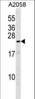 ZNF673 Antibody (aa96-125)
