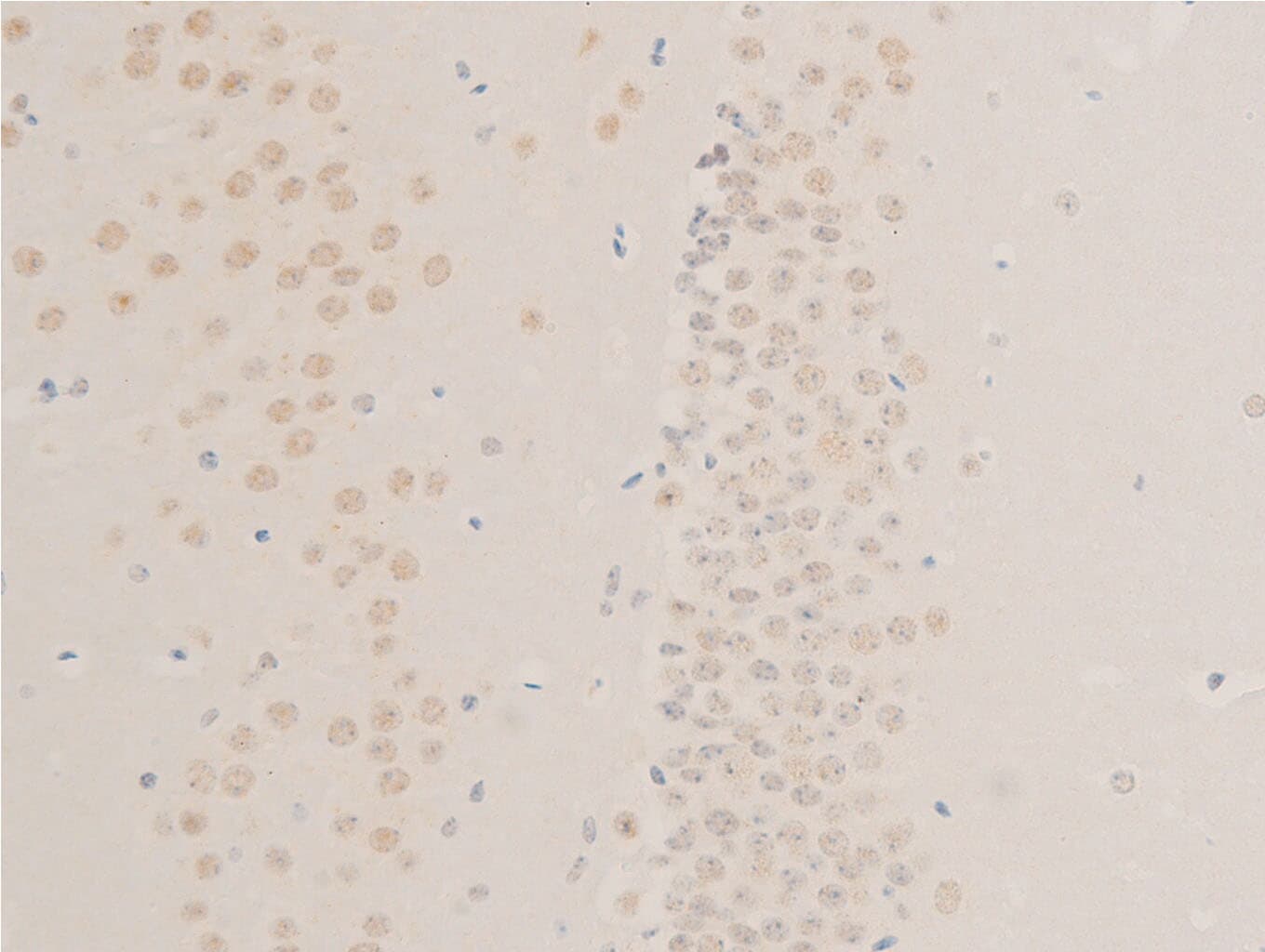 EGFR Antibody (phospho-Ser1026)