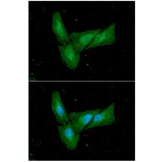 IHC-plus™ Monoclonal Mouse anti-Human C/EBP Beta / CEBPB Antibody (clone 47A1, IHC, IF, WB)