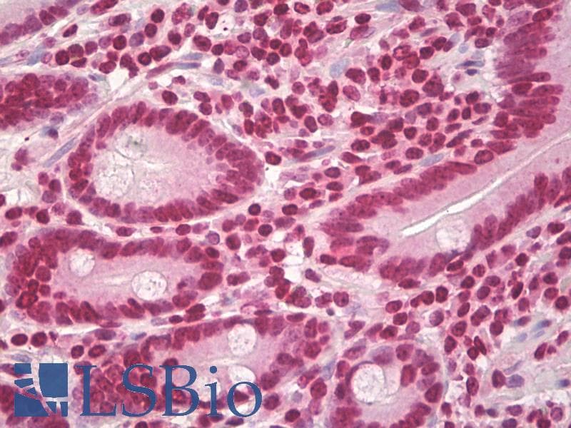 PathPlus™ Polyclonal Rabbit anti-Human CCND1 / Cyclin D1 Antibody (aa250-300, IHC, WB)