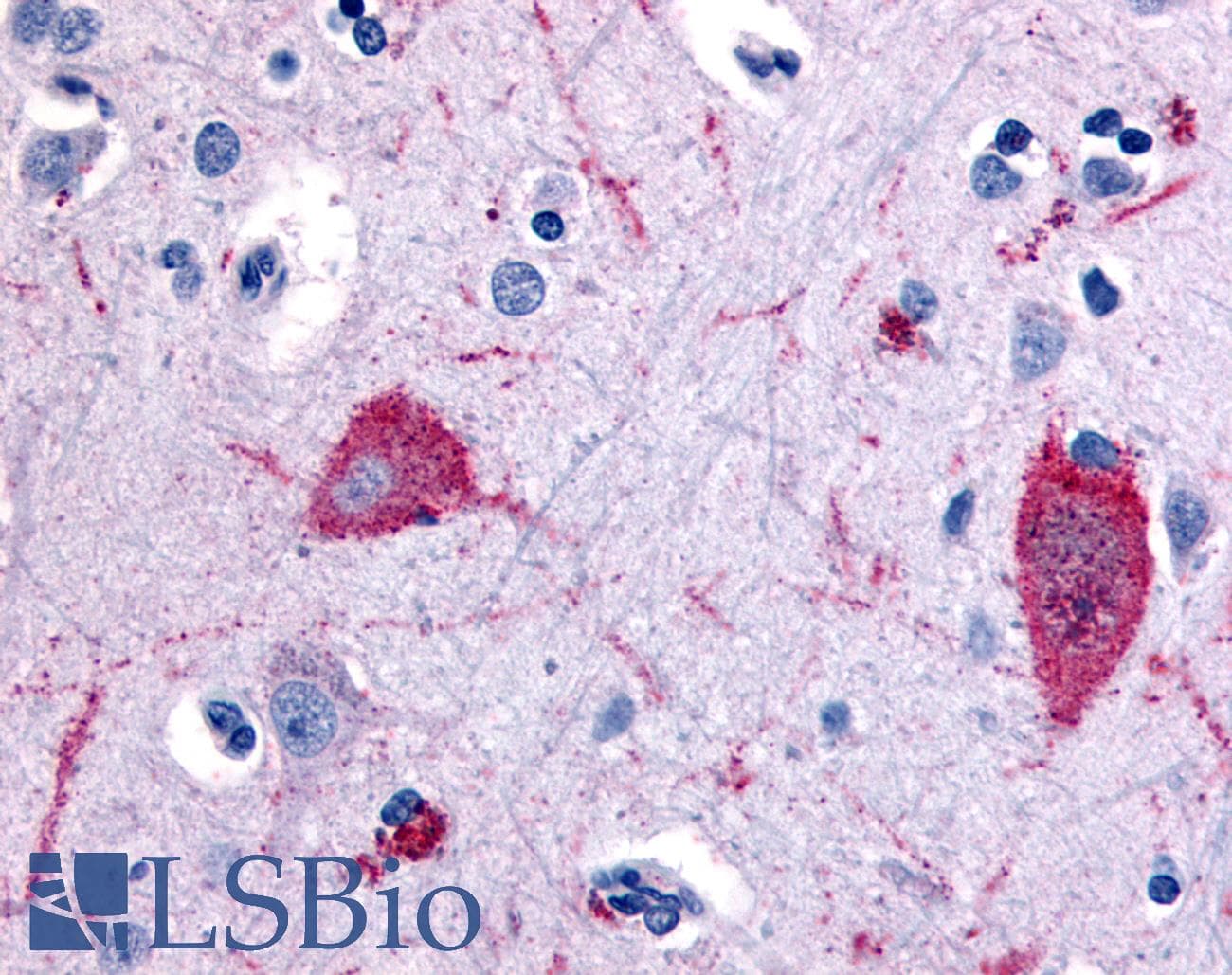 PathPlus™ HTR5A / 5-HT5A Receptor Antibody (N-Terminus)