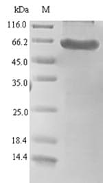 Human HTRA1 Protein (Recombinant 6His-SUMO, N-terminus)