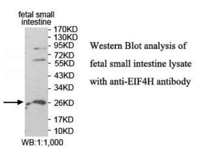 Polyclonal Rabbit anti-Human EIF4H Antibody (aa2-168, WB)