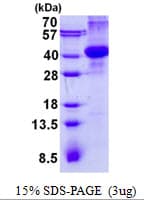 Human AMN Protein (Recombinant His)