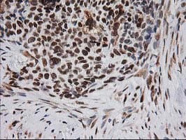 ERCC4 / XPF Antibody (clone OTI4E11)