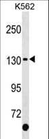 Polyclonal Rabbit anti-Human c-Kit / CD117 Antibody (aa878-905, WB)