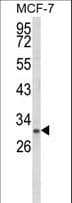IHC-plus™ Polyclonal Rabbit anti-Human NKX3-1 Antibody (aa118-145, IHC, WB)