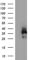EPCAM Antibody (clone OTI2E6)