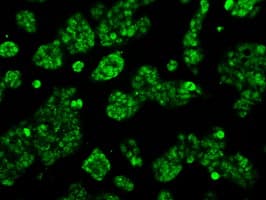 ACO2 / Aconitase 2 Antibody (clone OTI3G8)