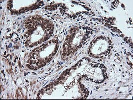 RTKN / Rhotekin Antibody (clone OTI2E9)