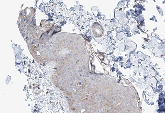 Polyclonal Rabbit anti-Human MAST4 Antibody (IHC, IF, WB)