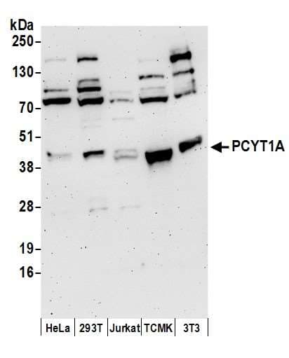 PCYT1A / CCT Alpha Antibody (aa1-50)