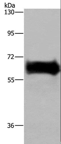 Polyclonal Rabbit anti-Human EZR / Ezrin Antibody (IHC, WB)