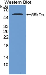 NUP153 Antibody (aa1238-1468, PE)